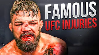 The Untold Truth About The Most Famous Injuries In UFC History!