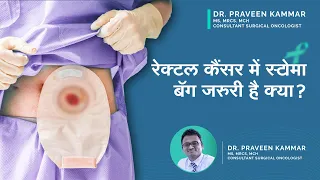 रेक्टल कैंसर में स्टोमा बॅग जरुरी है क्या ? | Stoma Bag in Rectal Cancer | Dr. Praveen Kammar