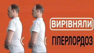 Випрямляємо Поперековий Лордоз