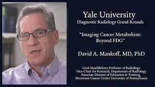 Imaging Cancer Metabolism: Beyond FDG