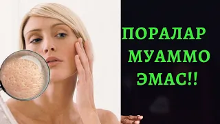 Поралар бу муаммо  эмас!!