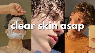 how to get a clear skin for guys (no bs!)