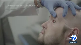 Man receives world's 1st transplant of entire human eye, plus new face