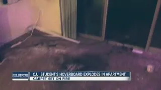 CU student's hoverboard exploded