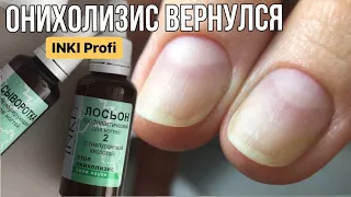 Онихолизис вернулся // Что делаем? Восстановление от INKI Profi