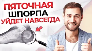 ПЯТОЧНАЯ ШПОРА | Как лечить и причины появления