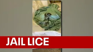 Video shows outbreak of lice in Fulton County jail