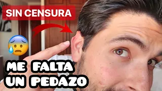 ¿QUÉ LE PASÓ A MI OREJA, Por qué la TENGO ASÍ? - Gabriel Herrera