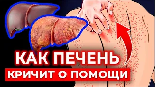 Скрытые признаки БОЛЬНОЙ ПЕЧЕНИ! | Спаси печень от ШЛАКОВ и ТОКСИНОВ!