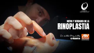 Dr. Wilder Pérez Willis - Mitos y Verdades de la Rinoplastia