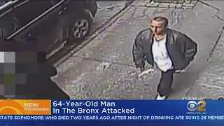 Man's Jaw Broken In Random Bronx Attack