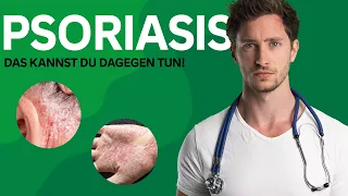 Das hilft bei Psoriasis!