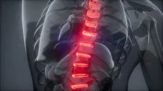 The Spinal Tapper by Sapien Medicine