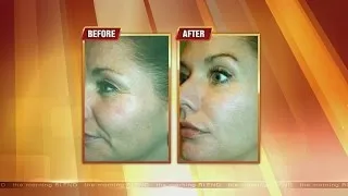 Look Younger Without Dramatic Plastic Surgery 1/13/15