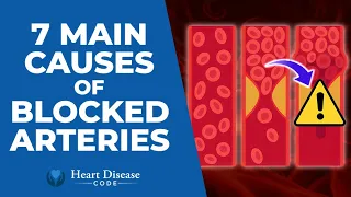 7 Main Causes of Blocked Arteries