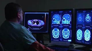 Was ist alkoholische Enzephalopathie