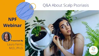 Q&A About Scalp Psoriasis