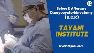 Before & After DCR (Dacryocystorhinostomy) Surgery | Tayani Institute