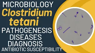 Clostridium tetani pathogenesis | Clostridium tetani microbiology | lab diagnosis, treatment