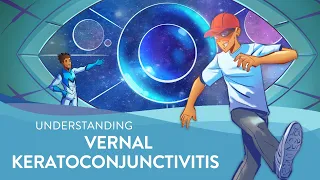 Understanding Vernal Keratoconjunctivitis (VKC)