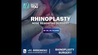 Live Demonstration of Rhinoplasty Surgery for Nose Shape Correction, Nose Reshaping Surgery in Delhi