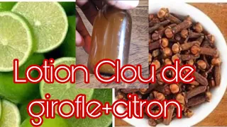 Lotion clou de Girofle+citron efficace contre l’acné et les taches