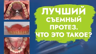 Лучший съемный протез. Что это такое?