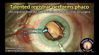 CataractCoach 1192: talented UK ophthalmology registrar performs phaco