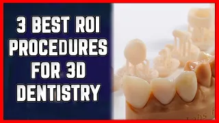 🦷 3 Most Profitable 3D Dental Printing Procedures (2023)