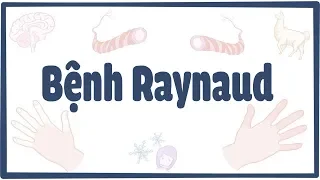 Bệnh Raynaud (tím tái ngón tay/chân)