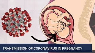 Transmission of coronavirus in pregnancy