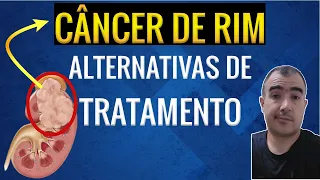 Câncer no rim e as alternativas de tratamento