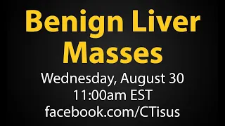 Facebook Live: Benign Liver Masses