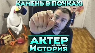 Актер | История | Как выходил камень из почек!