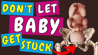 How to prevent that Baby gets stuck during Labor: Reasons why Babies get stuck and what to do