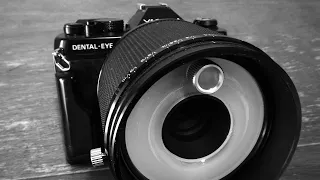 52 Cameras: Yashica Dental Eye