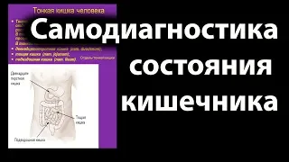 Самодиагностика состояния кишечника. (№4 из цикла самодиагностика)