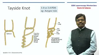 Laparoscopic suturing and Knotting | Dr S Easwaramoorthy | SEM | Master Class| Lotus Hospital, Erode