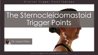 The Sternocleidomastoid Trigger Points