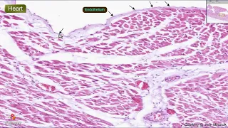 Histology of the Heart wall - Shotgun Histology