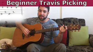 20 Beginner Travis Picking Exercises & Patterns - Ultimate Guitar Tutorial w/ TAB