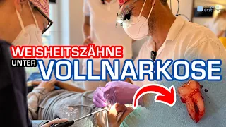 VOLLNARKOSE: ALLE 4 WEISHEITSZÄHNE ZIEHEN (Zahnarzt)