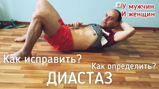 Диастаз – у женщин и МУЖЧИН. Что это, как определить и как исправить!?