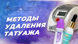 Что выбрать для удаления татуажа. Лазер или ремувер?