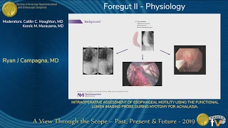 Intraoperative Assessment of Esophageal Motility Using...