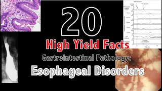 20 High Yield Facts: Esophageal Disorders: for USMLE Step 1/COMLEX Level 1