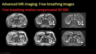 CT and MRI of renal masses