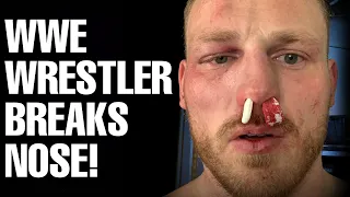 WWE SUPERSTAR RIDGE HOLLAND SUFFERS A BROKEN NOSE AT WWE DAY 1 - WWE NEWS