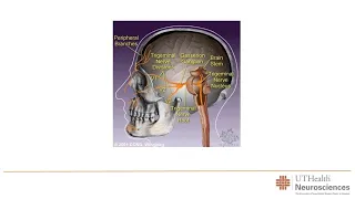 TRIGEMINAL NEURALGIA - MY STORY