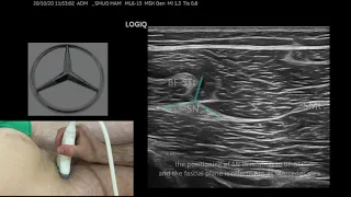 Proximal hamstrings ultrasound landmarks - SMUG 2 mins series